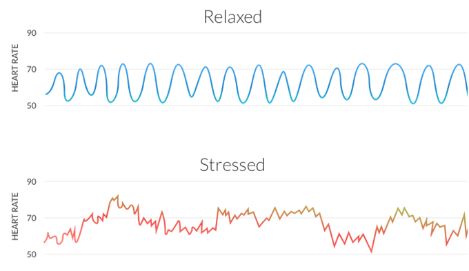 Heart rate variability Heart rate variability