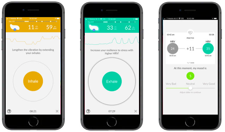 Heart rate variability Heart rate variability