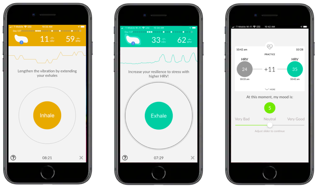 Best practices for measuring heart rate variability Best practices for measuring heart rate variability