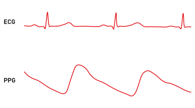 The limitations of PPG based measurements The limitations of PPG based measurements