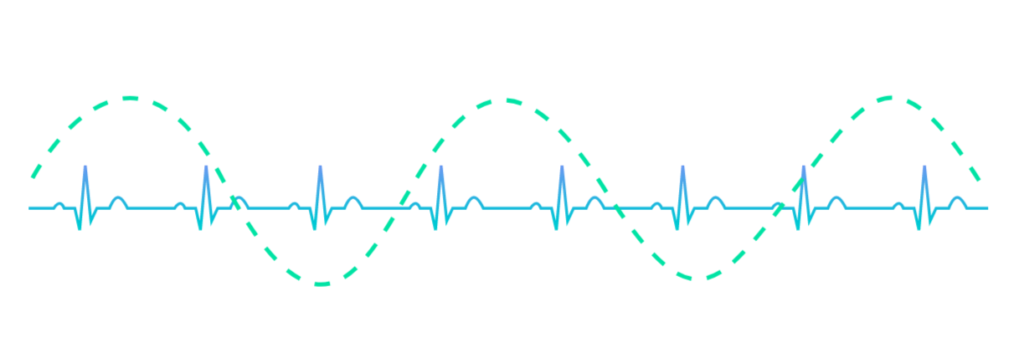 HRV biofeedback HRV biofeedback